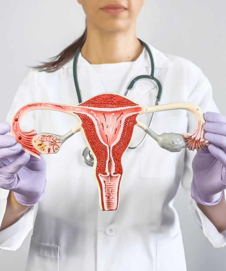 Aké príznaky naznačujú PCOS a aká je liečba polycystických vaječníkov?